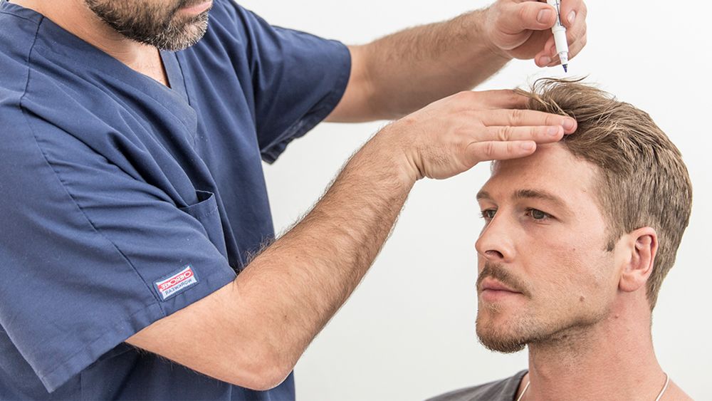 Handy Benefits Of Getting Hair Transplant Therapy - 5Blog